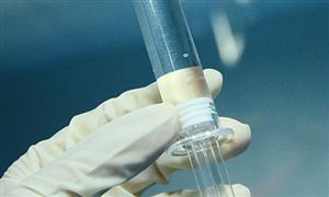 玻尿酸行業市場分析深度報告 2021年國內玻尿酸市場占有率分析