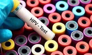 山東省已為260萬農村適齡婦女進行免費“兩癌”檢查 HPV疫苗市場發展現狀分析