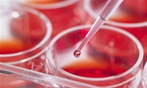 2022年蝦青素行業(yè)現(xiàn)狀及發(fā)展前景分析