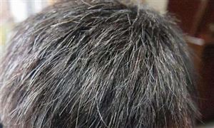 白頭發是什么原因引起的?2022染發劑行業發展前景及未來趨勢分析