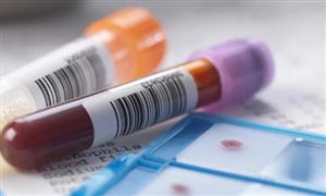 血液制品市場現(xiàn)狀分析 預(yù)計未來幾年中國血液制品市場規(guī)模將會持續(xù)走高?