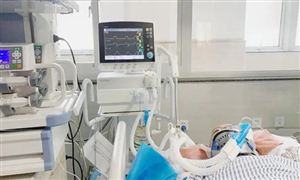 呼吸機(jī)行業(yè)發(fā)展前景分析