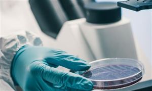 體外診斷(IVD)行業競爭格局 體外診斷(IVD)行業發展趨勢預測