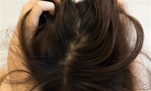 去屑洗發水行業市場需求如何?去屑洗發水行業發展趨勢分析