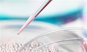 癌癥檢測行業(yè)市場需求如何?癌癥檢測行業(yè)市場調(diào)研報告2023