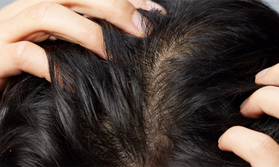 生發(fā)藥物行業(yè)發(fā)展分析 生發(fā)藥物行業(yè)市場投資潛力