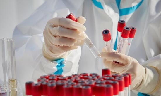 賴氨酸行業現狀及前景趨勢分析2023