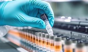 國內硫酸市場價格暴漲近200% 這兩家公司具有較大業績彈性