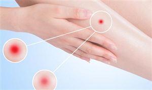 中國皮膚病藥物行業市場規模 中國皮膚病藥物行業需求分析