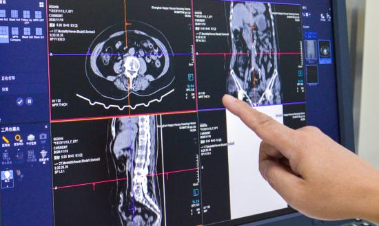 我國醫學影像設備行業市場分析2024
