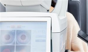 中國眼科OCT設備市場發展調查分析及投資策略研究2024