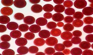 2024蝦青素產(chǎn)業(yè)發(fā)展報告：蝦青素市場需求具有多元化趨勢