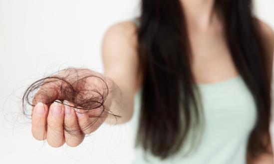 30歲前脫發的比例高達84% 毛發氨基酸行業分析