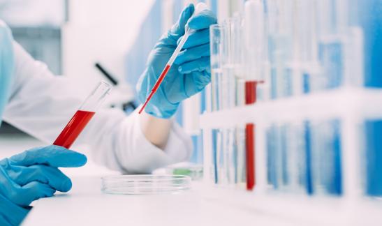 2025年中國人血白蛋白行業(yè)競爭分析及發(fā)展前景預(yù)測