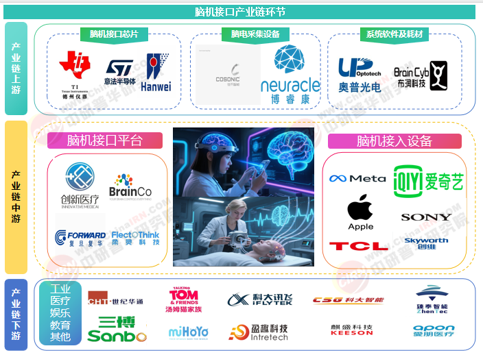 2025年中國腦機接口市場現狀分析及發展前景預測