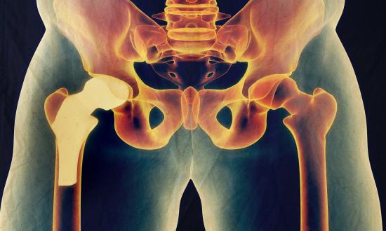 2025中國人工關(guān)節(jié)行業(yè)：重塑“膝”望，點亮“髖”心